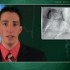 Lack of sleep in early middle age tied to coronary artery calcification
