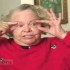 "Drooping Eyelid" Repair Surgery