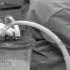 Body by DMC: High Definition Liposuction