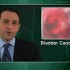 Delayed surgery for bladder cancer increases mortality
