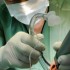Managing acute liver failure in a transplant center