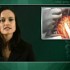 Ventricular reduction surgery with CABG does not improve outcomes