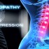 Artificial cervical discs