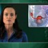 High-intensity focused ultrasound feasible for uterine localized adenomyosis in small study