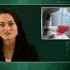 Smoking does not up mortality in liver transplant recipients