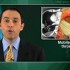 Right cardiac thrombus tied to mortality with pulmonary thromboemboli