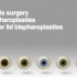 Eye surgery transitioning from OR to the office