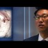 Artificial corneas vs corneal transplant