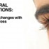 Thyroid eye disease referral