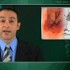 Long-term therapy with proton pump inhibitors appears safe