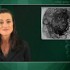 Thiopurines for IBD raise risk of lymphoproliferative disorders