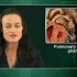 Long-term ambrisentan therapy useful for pulmonary arterial hypertension