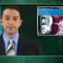 Prostate cancer-specific mortality extremely low during active surveillance