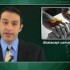 Abatacept does not increase malignancies in rheumatoid arthritis patients