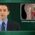 Many endoscopy patients at high risk for obstructive sleep apnea