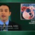 Interruptions in anti-HIV therapy carry high risk of thrombocytopenia