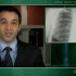 Improved Aerobic Capacity for COPD Patients