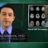 New oral agents effective against relapsing multiple sclerosis