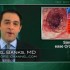 Long-term antibiotic treatment effective for Crohn’s disease
