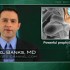 Probiotic formula prevents diarrhea