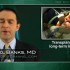 Deadly fungal infections often occur late after organ transplantation