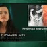 High-potency probiotic mix has benefits in relapsing ulcerative colitis