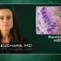 Mucolytic pretreatment effective against antibiotic-resistant H. pylori