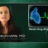 Vernakalant safely converts recent-onset A-fib to sinus rhythm