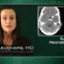 IV magnesium may do more harm than good in subarachnoid hemorrhage