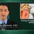 Clopidogrel loading just prior to PCI seen effective