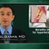 Benefits of candesartan for hypertension and CAD
