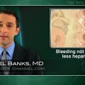 Reduced Heparin During PCI