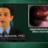 Appendectomy delay doesn’t affect short-term outcomes