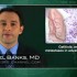 Gefitinib, erlotinib may slow CNS metastases in advanced lung cancer