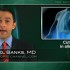 Subcutaneous omalizumab helps cut corticosteroids in allergic asthma
