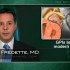 Glycoprotein IIb/IIIa inhibitors still add benefit in elective PCI