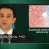 Hepatitis C guidelines focus on eradication of virus before liver damage occurs