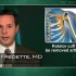 Calcium deposits in rotator cuff can be removed arthroscopically