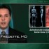 Glucocorticoid-related bone loss prevented with zoledronate