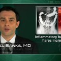 Risk of VTEs increased during inflammatory bowel disease flares