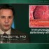Immunosuppressives not definitively effective in IBD