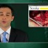 Inhibitor of von Willebrand factor reduces thromboembolism after carotid endarterectomy