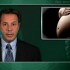 Expectant management an option in select women with severe preeclampsia before 34 weeks gestation