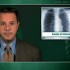 Considerable risk of pneumothorax seen with transthoracic needle lung biopsy