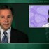 Bortezomib of uncertain benefit in therapy for follicular lymphoma