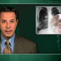 Antibiotic strategies comparable for P aeruginosa in kids with CF