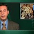 Combination therapy of little benefit in pulmonary hypertension