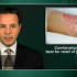 Combination therapy seems best for relief of psoriasis: report