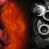 Longer screening interval for retinopathy might be safe for some diabetics