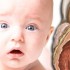 No apparent benefit to early medical therapy for patent ductus arteriosus: study